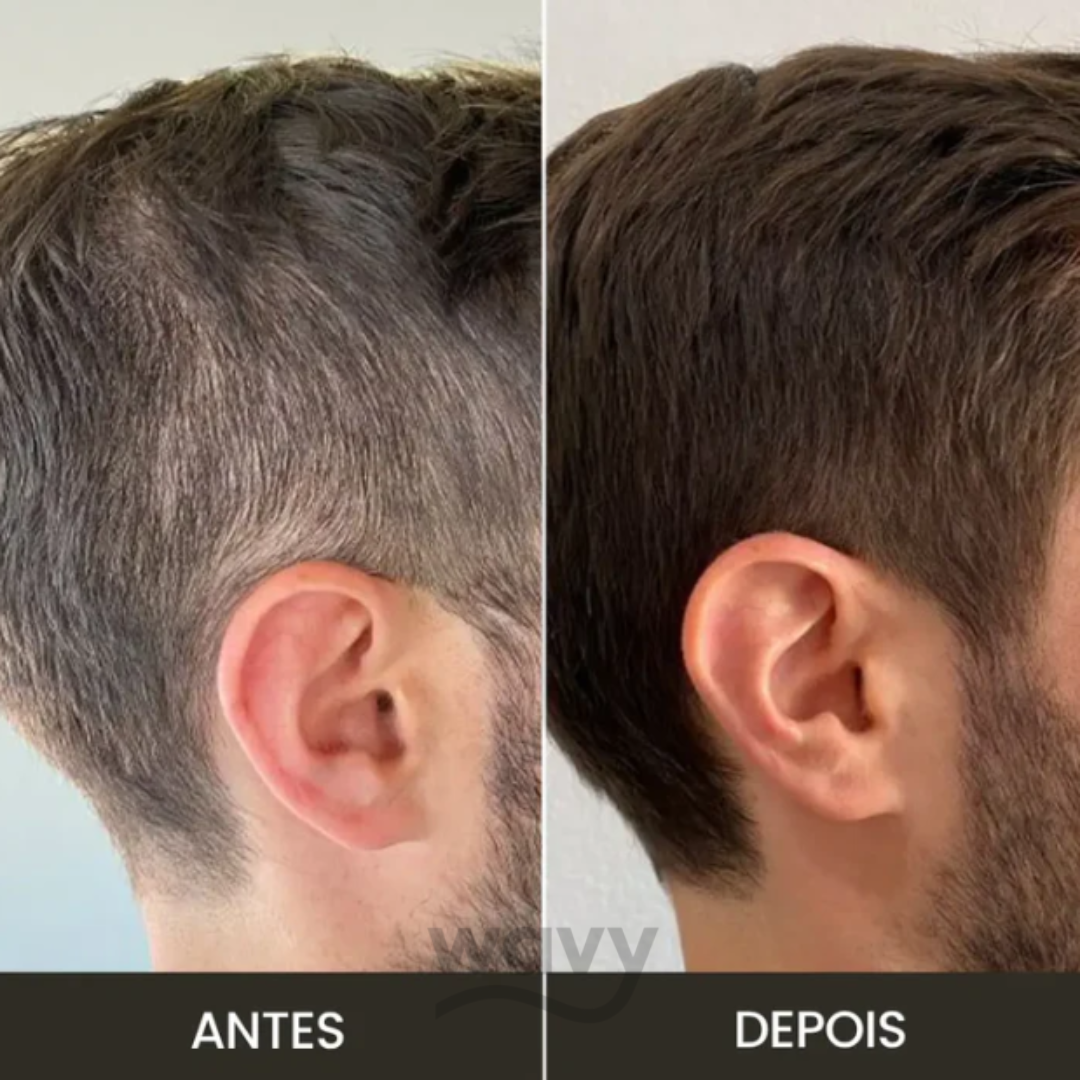 Toppik - Cobertura Instantânea para Falhas Capilares