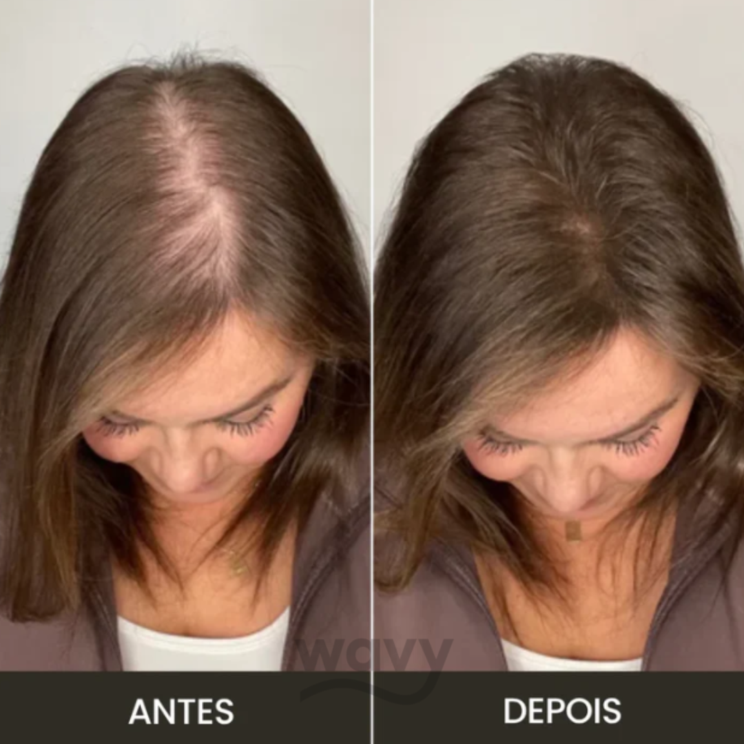 Toppik - Cobertura Instantânea para Falhas Capilares