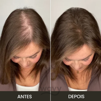 Toppik - Cobertura Instantânea para Falhas Capilares